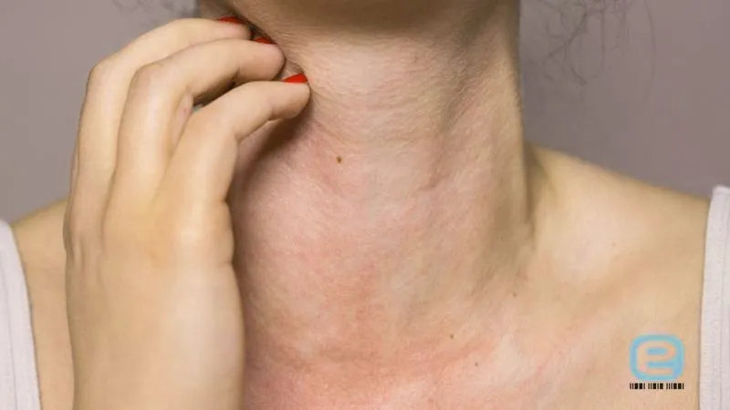 Alergia na banany u niemowląt karmionych piersią – co warto wiedzieć?