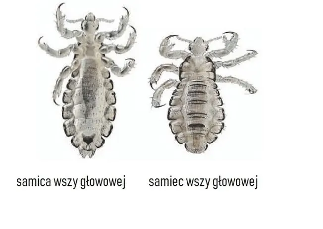 Kiedy dziecko po leczeniu wszawicy może znowu bawić się w przedszkolu?
