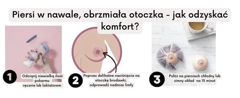 Kiedy następuje nawał pokarmu w 2 dobie po porodzie? Opcje i porady dla mam