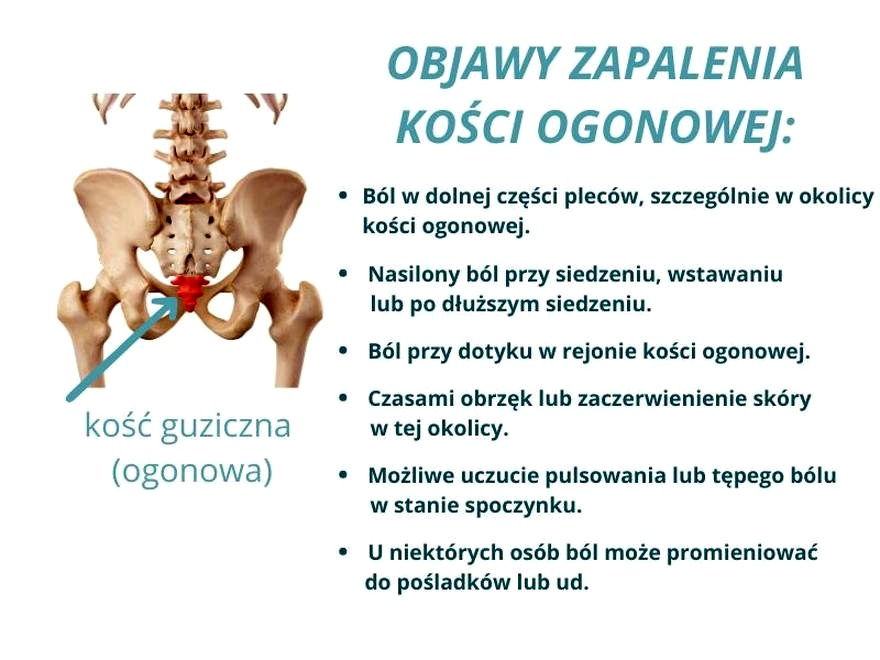 Kość ogonowa po porodzie boli? Przyczyny i sposoby ulgi