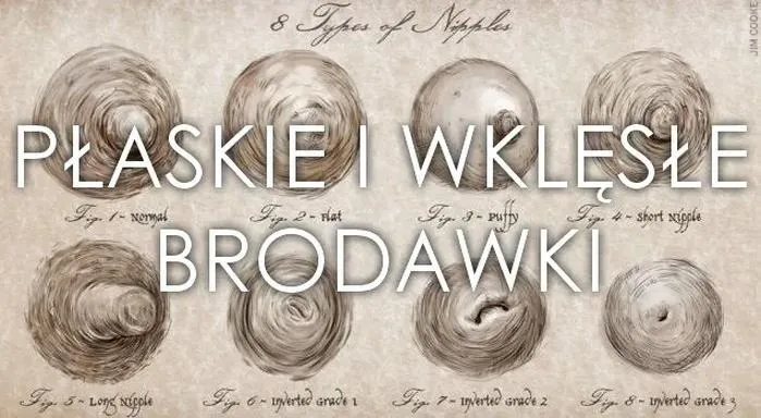 Płaskie sutki a karmienie piersią: praktyczne porady dla mam