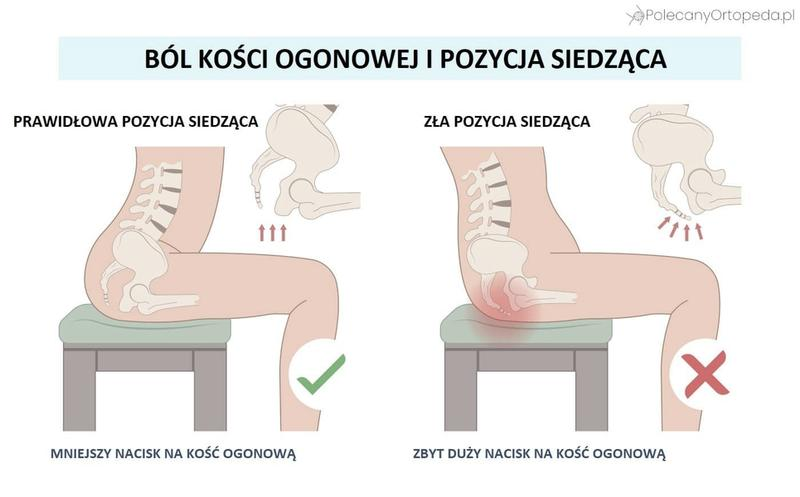Ból kości ogonowej po porodzie