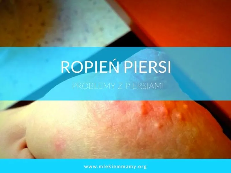 Karmienie piersią