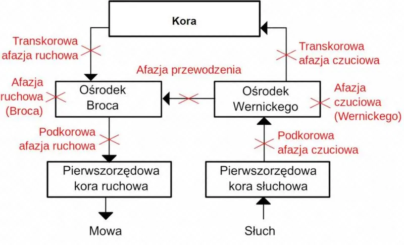 Terapia afazji u dzieci